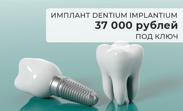 Акции https://pearlkzn.ru/wp-content/uploads/2022/07/mini-akcii-impl.jpg