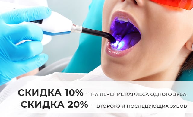 Акции https://pearlkzn.ru/wp-content/uploads/2022/07/mini-akcii-karies.jpg